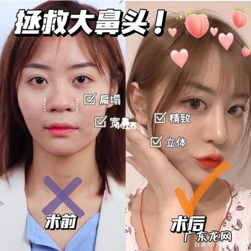 怎么样让鼻子看起来更好看