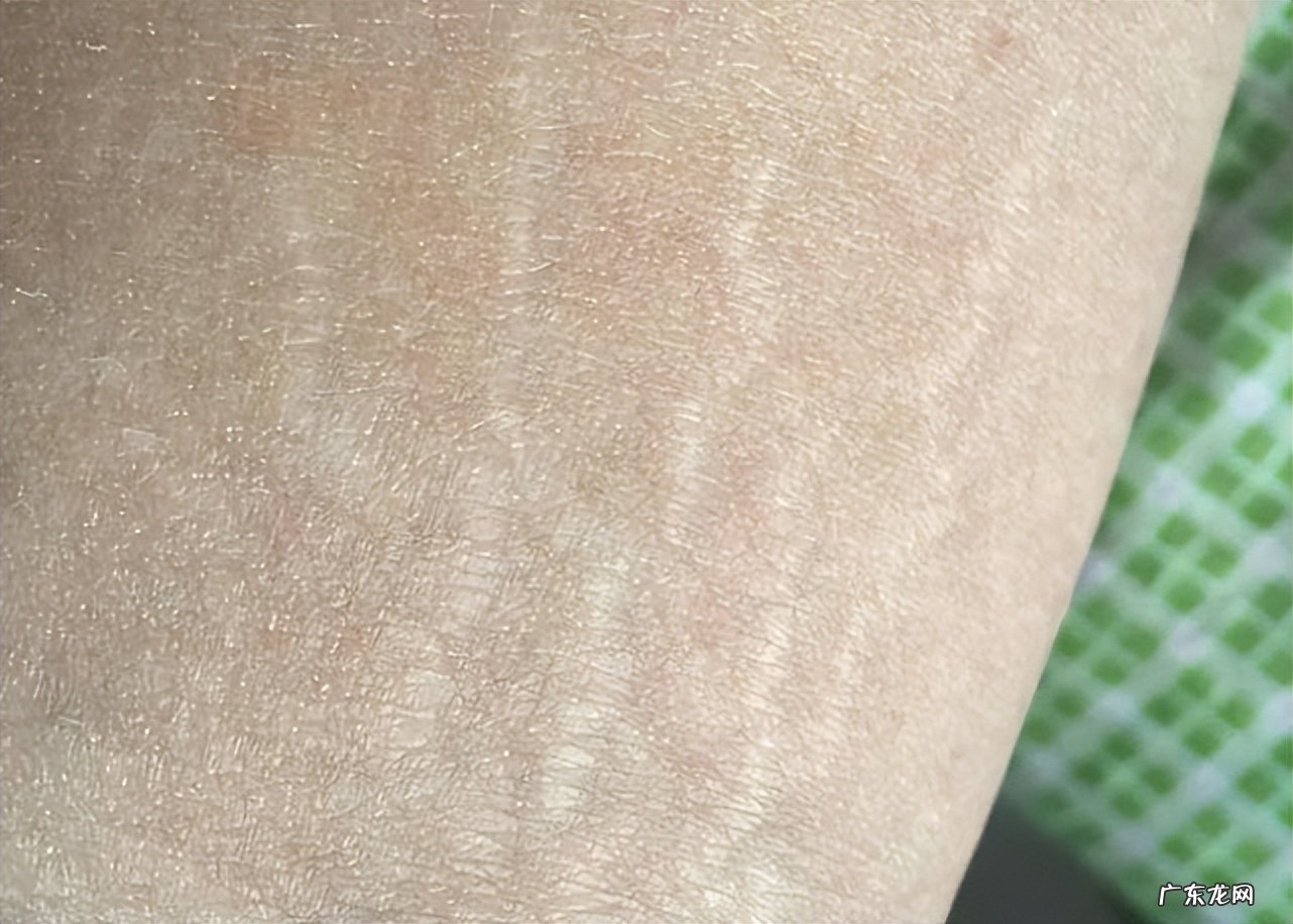和女友同居第一天,去洗澡发现她屁股大腿都有白纹,这是咋回事?