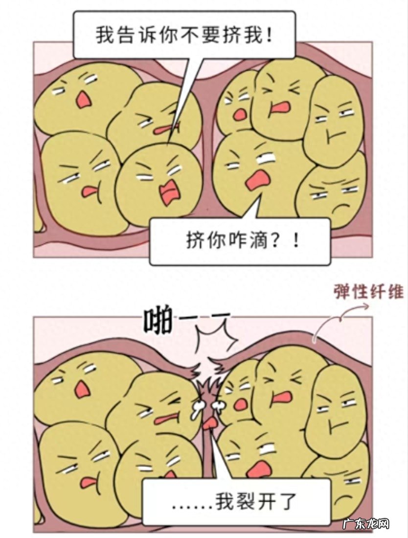 和女友同居第一天,去洗澡发现她屁股大腿都有白纹,这是咋回事?
