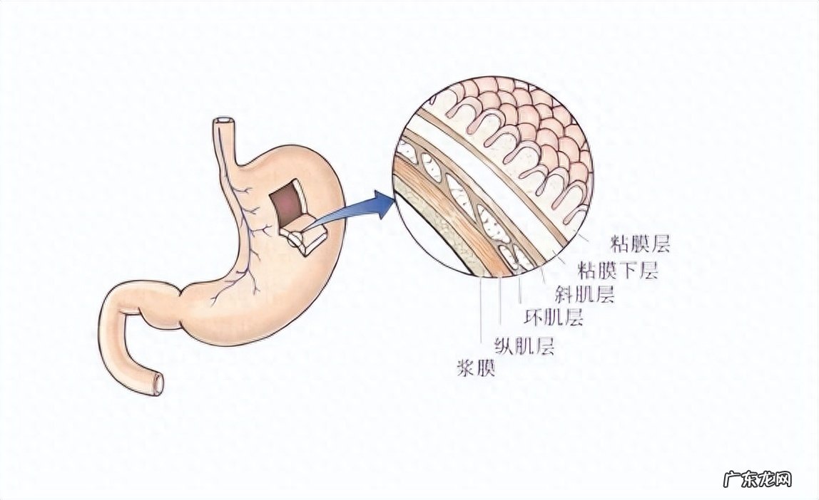 胃病的“根源”是胃黏膜损伤？3个方法帮助修复，胃病或不攻自破