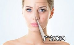 化妆品过敏脸肿怎么办 多久会不肿了