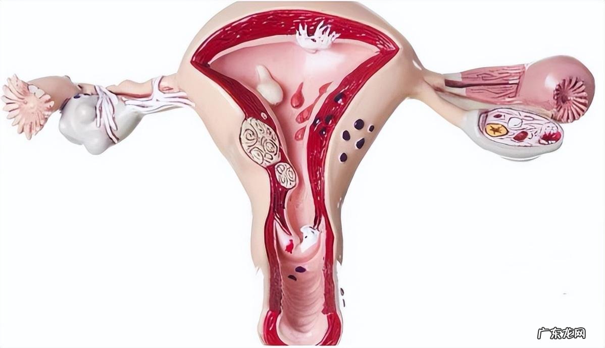 女性“巨阴症”是病?真会影响生育?医生直言:主要看这3种情况