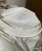 白色衣服为什么会发黄,为什么白衣服腋下会变黄
