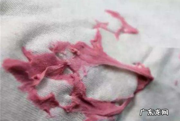 衣服上弄上口香糖怎么能处理掉,衣服上沾了口香糖怎样去除