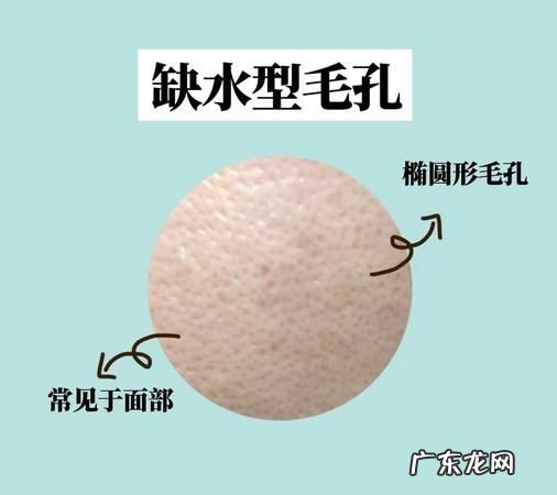 怎么改善毛孔变大,改善面部毛孔粗大的妙招