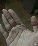 手下水后就皱什么情况,为什么手泡在水里久了会起皱纹