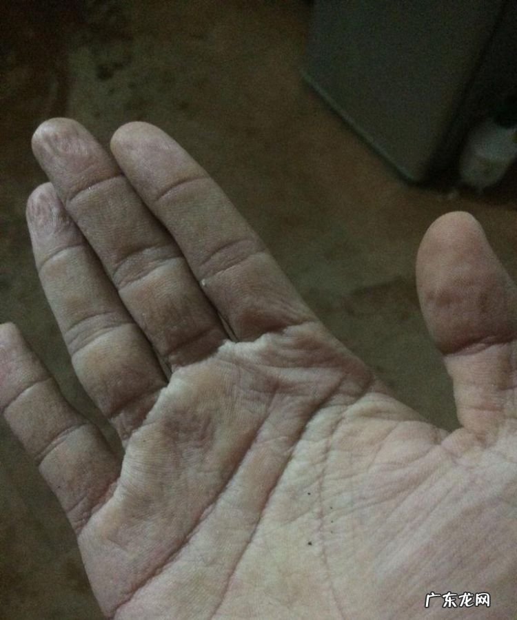 手下水后就皱什么情况,为什么手泡在水里久了会起皱纹