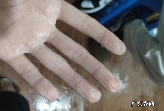 手下水后就皱什么情况,为什么手泡在水里久了会起皱纹