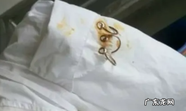 衣服生锈了怎么洗掉,如何洗掉衣服的血渍