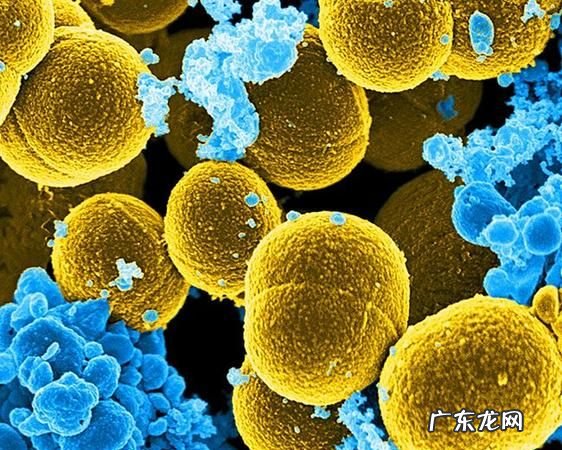 金黄色葡萄球菌是什么,金黄色葡萄球菌是革兰氏阴性菌还是阳性菌