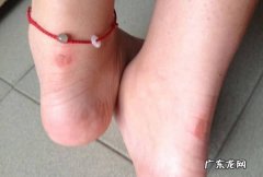 鞋子磨脚后跟怎么办,鞋子磨脚后跟怎么处理就不磨脚了
