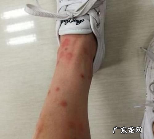 家里有跳蚤怎么清除最方便有效,家里有小孩有跳蚤怎么彻底消除