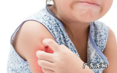 驱蚊液配方成分,灭蚊剂闻多了有什么后果