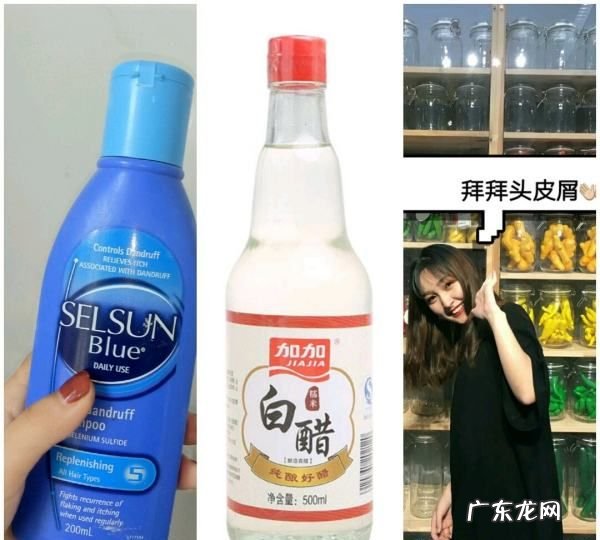 怎么样洗头去头屑有效,去头皮屑方法有哪些