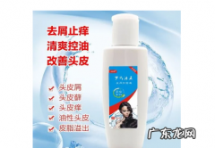 怎么样洗头去头屑有效,去头皮屑方法有哪些