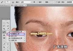 ps如何去除斑点,ps怎么去除脸上的痘痘斑点