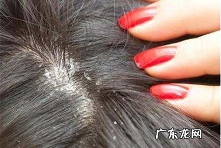 怎么判断床上有没有虱子,怎么判断床上有没有虫子