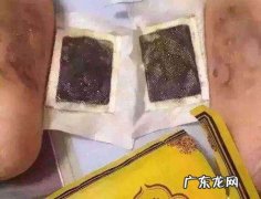 除湿贴变黑的原理,足贴真的可以祛除湿气