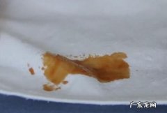 油渍可以干洗掉吗？,衣服有油渍可以拿去干洗洗得掉