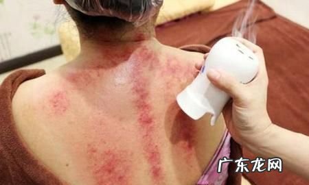 刮痧后多久可以洗澡,刮痧后多长时间洗澡