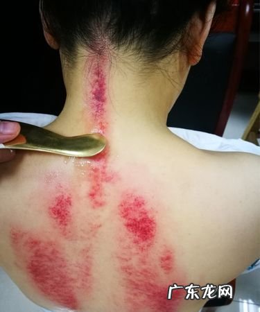 刮痧后多久可以洗澡,刮痧后多长时间洗澡