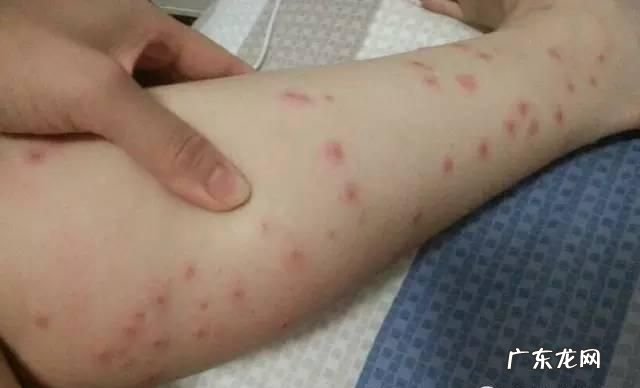小咬是什么虫子,小咬是什么虫子