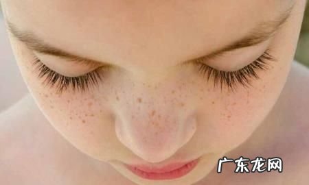 小苏打能去老年班,小苏打如何去斑点