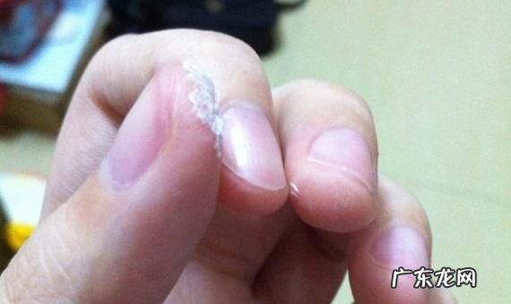 手上沾了三秒胶怎么去除,三秒胶粘在手上怎么才能快速弄干净
