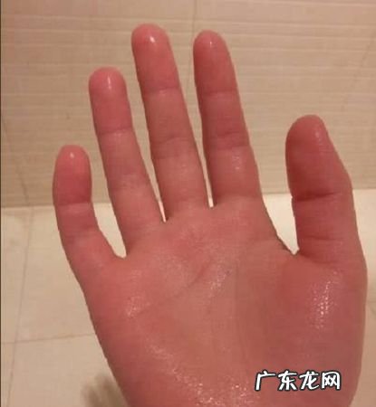 手老是出汗怎么回事,手老出汗是怎么回事