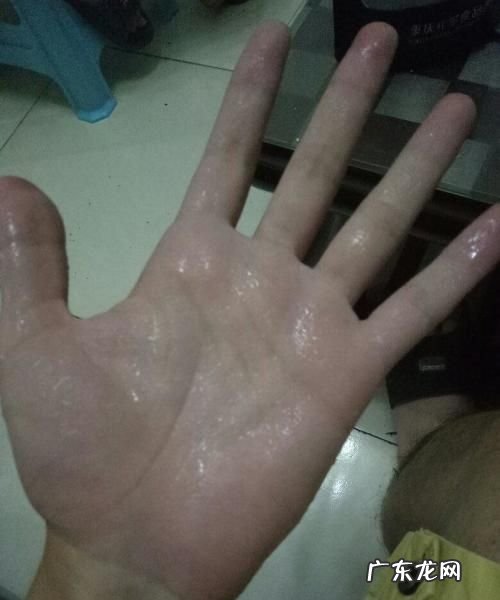 手老是出汗怎么回事,手老出汗是怎么回事