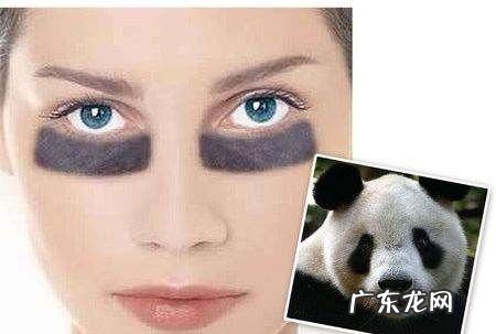 什么样的人会有黑眼圈,三十岁的女人有黑眼圈是怎么回事