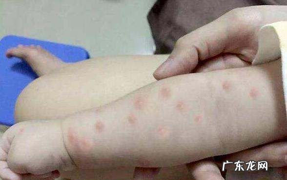 避蚊胺含量多少安全,儿童避蚊胺含量多少安全