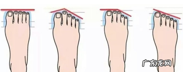 脚型分为哪几种类型图片,脚型分为哪几种类型