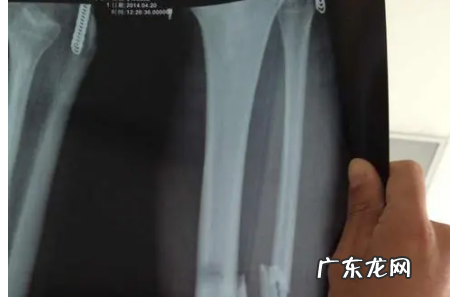 什么叫单骨双骨,骨头分单骨和双骨