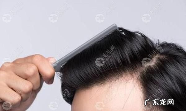 增加发量的方法,发量增多方法