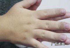 手脚发胀是怎么回事,到晚上手脚发胀是怎么回事