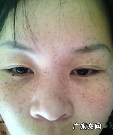 黑星子怎么去除小妙招,黑星子用普通话怎么讲的