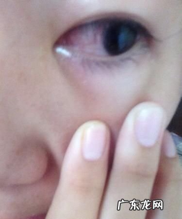 怎么把眼睛变红,什么办法能把眼睛搞红搞肿