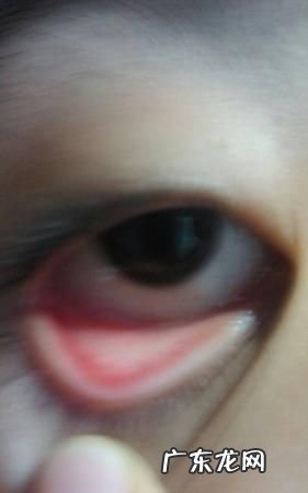 怎么把眼睛变红,什么办法能把眼睛搞红搞肿