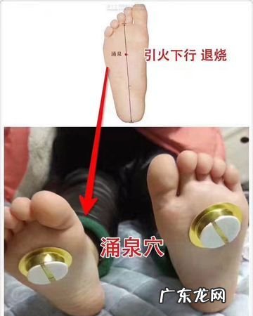艾脐贴贴涌泉的功效和作用,三伏灸的作用