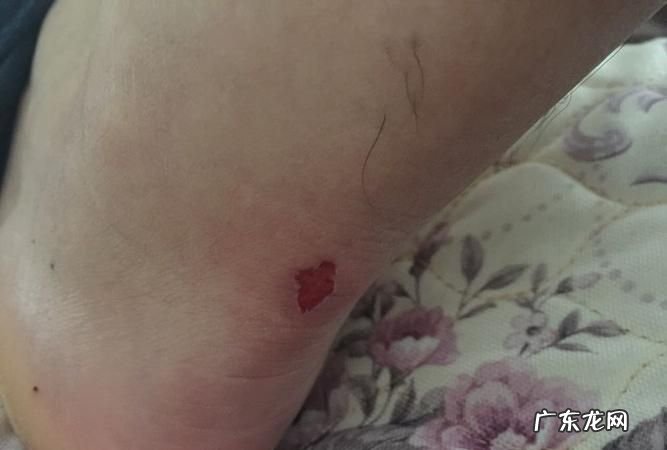 鞋子后面磨脚怎么办,运动鞋子后跟磨脚怎么办小妙招