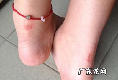 鞋子后面磨脚怎么办,运动鞋子后跟磨脚怎么办小妙招