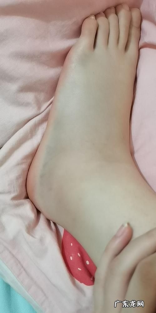脚歪着了怎么处理最好,崴了脚怎么在家处理的方法
