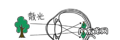 儿童散光的矫正方法是什么,散光是可以矫正过来的