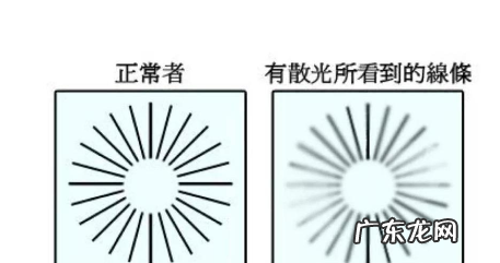 儿童散光的矫正方法是什么,散光是可以矫正过来的