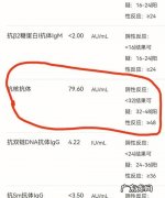 抗体是什么意思好的还是坏,什么叫做抗体和抗原
