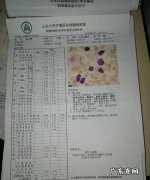 白血病痊愈后可以买保险,我女儿现在查出白血病了怎么办