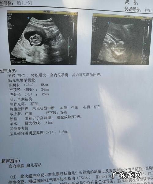 nt值多少为正常,nt值多少为正常