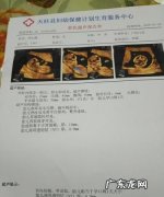 nt值多少为正常,nt值多少为正常