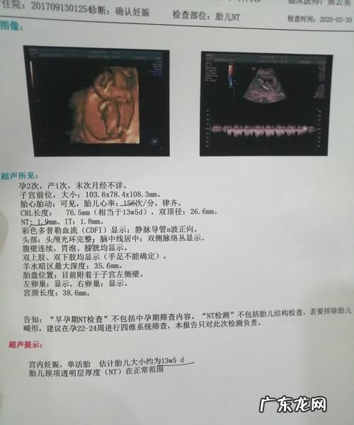 nt值多少为正常,nt值多少为正常